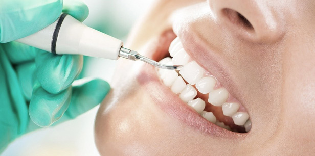 Ультразвуковая чистка зубов в Ставрополе