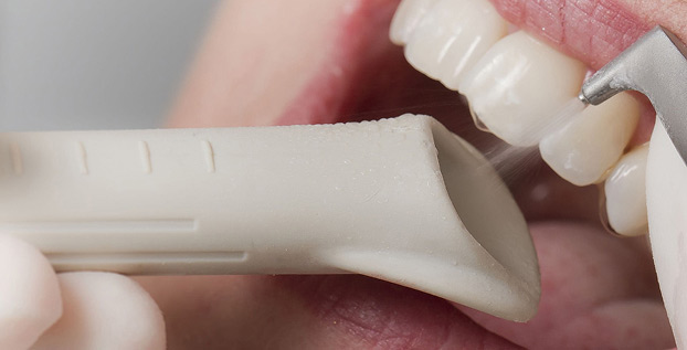 Чистка зубов Air Flow в Ставрополе