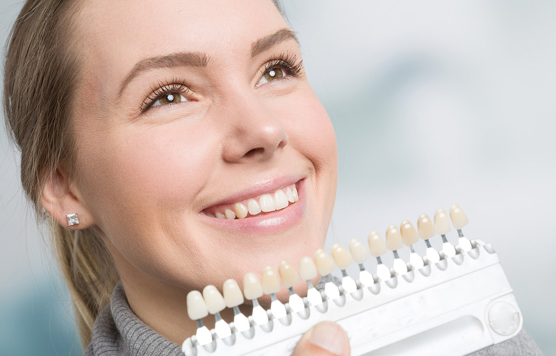 Как отбеливают зубы