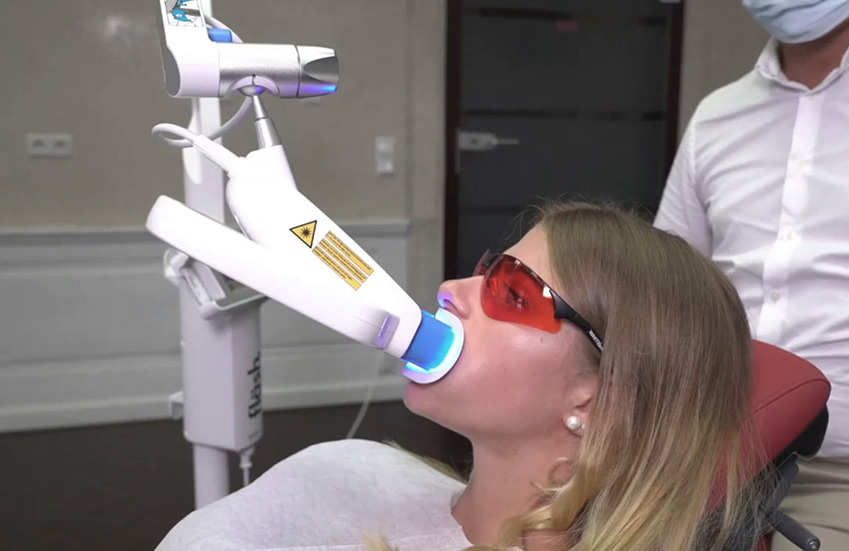 Fläsh система отбеливания зубов