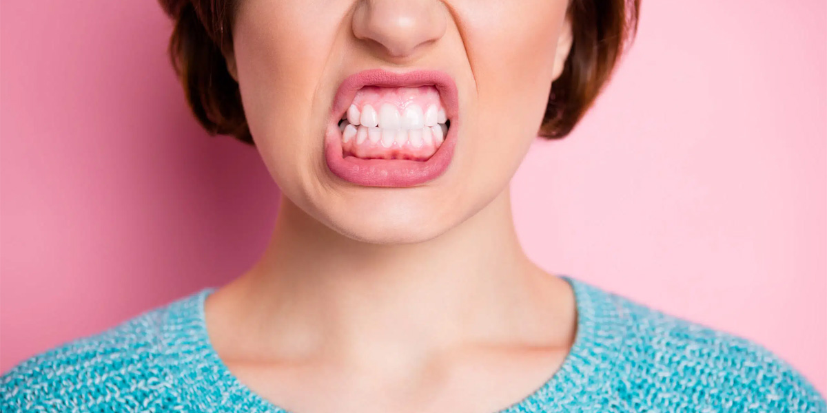 Бруксизм: причины, симптомы, диагностика и современные подходы к лечению