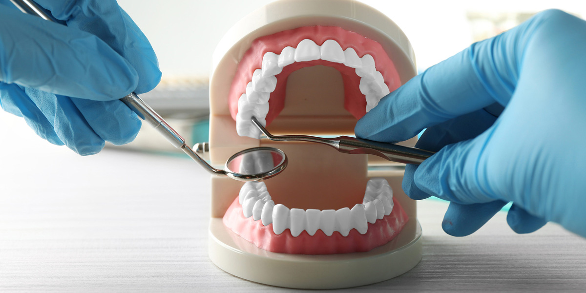 Контактный кариес — скрытая угроза!