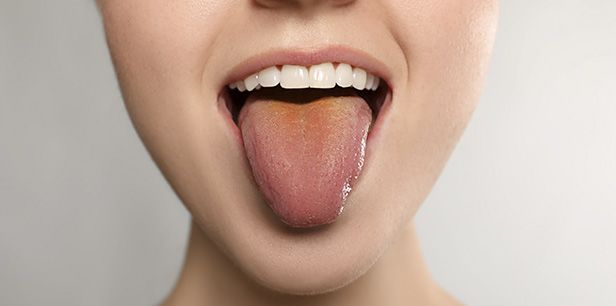 Как по языку узнать о проблемах в организме: расшифровка цветов, налёта и форм