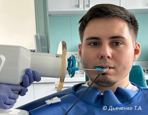 Рентген диагностика контактных пунктов